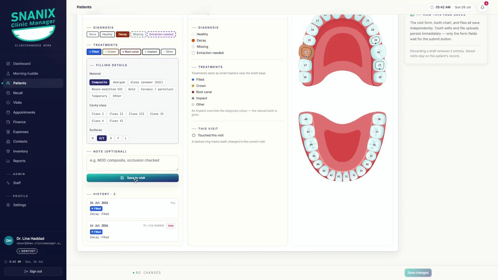 Charting, tooth by tooth